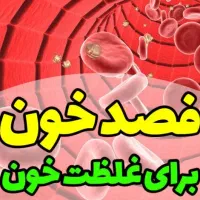 * فصد خون کیسه ای و حجامت تخصصی قلب*