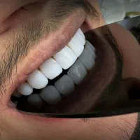 خدمات دندانپزشکی زیبایی و درمانی