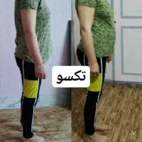 لاغری، چاقی،چاقی صورت،ناباروری،کبد چرب