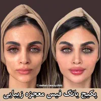 تخفیف یانگ فیس صورت ابرو پزشک پوست مو بینی زیبایی|خدمات آرایشگری و زیبایی|مشهد, هفت تیر (آب و برق)|دیوار