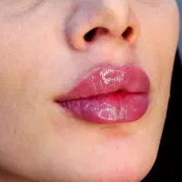 تخفیفات ژل و بوتاکس ومزوتراپی (آموزش۴ونیم)|خدمات آرایشگری و زیبایی|خرم‌آباد, |دیوار