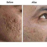 فیشیال و درمان عارضه های پوستی|خدمات آرایشگری و زیبایی|اصفهان, محله اسلامی|دیوار