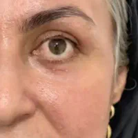 کرم گیاهی سفید کننده|آرایشی، بهداشتی، درمانی|زنجان, |دیوار