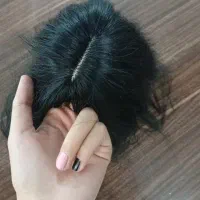 موی مصنوعی پروتز موی سر