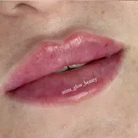 آموزش  و ارائه  ژل و بوتاکس و مزو|خدمات آموزشی|شیراز, سینما سعدی|دیوار
