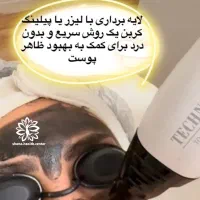 کربن تراپی (پاکسازی هالیوودی)باتخفیفات 50%