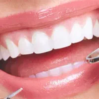 همکار دندان پزشک پروانه دار اردبیل