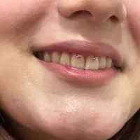 پیرسینگ همه نقاط۲۰۰آموزش پیرسینگ فقط۱۲۰۰(چت فعاله)