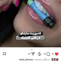 کامپوزیت دندان فکی ۸ میلیون با ضمانت ده ساله