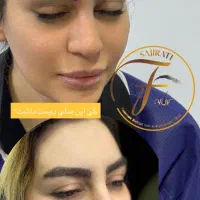 کاشت ابرو تخصصی در درمانگاه کمیل|خدمات آرایشگری و زیبایی|اهواز, زیتون کارمندی|دیوار