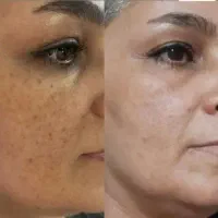 پاکسازی بدن و لاغری