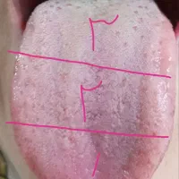 درمان ناباروری