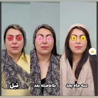 آغازجشنواره زیبایی پوست باهایفوتراپی وآراف فرکشنال