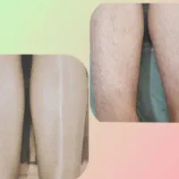 اپیلاسیون تخصصی با سابقه کاری بالا