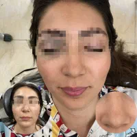 مدل برای فشیال و ناخن  فقط هزینه مواد