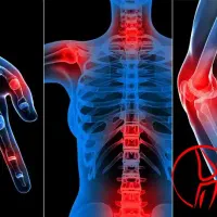 خداحافظی با درد مفاصل ودرد روماتیسم با قدرت طبیعت|خدمات آرایشگری و زیبایی|اردبیل, |دیوار