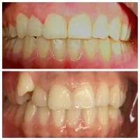 ارتودنسی. دندانپزشکی