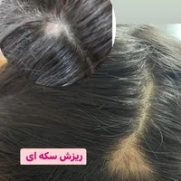 پاکسازی کف سر اسکراب اسکالپ|خدمات آرایشگری و زیبایی|مشهد, الهیه|دیوار