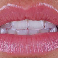 کلینیک دندانپزشکی تخصصی آروان|خدمات آرایشگری و زیبایی|کرمانشاه, |دیوار