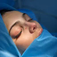 جراحی بینی ۲۴میلیون|خدمات آرایشگری و زیبایی|اسلامشهر, شهرک قائمیه|دیوار