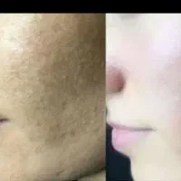 کرم معجزه کرم ضد لک قوی