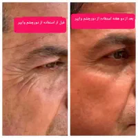 جوانسازی|آرایشی، بهداشتی، درمانی|شیراز, ابیوردی|دیوار