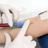 نمونه گیری آزمایش در منزل