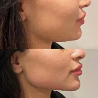 تخفیفات۵۰ درصدی ژل،بوتاکس،انزیم کیلینیک هستی|خدمات آرایشگری و زیبایی|کرمانشاه, |دیوار