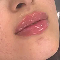 دعوت به همکاری از پزشک پوست، مو و زیبایی (خانم)