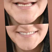 ساخت انواع دندانهای مصنوعی و متحرک|خدمات آرایشگری و زیبایی|شیراز, پودنک|دیوار