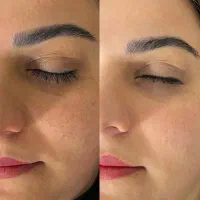 پاکسازی و فیشیال vipپوست ۲۰۰ویژه ۳روز