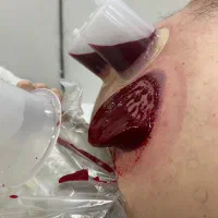 حجامت تخصصی خاص و عام پاییزه