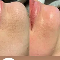 پاکسازی پوست به صورت تخصصی(بانوان)|خدمات آرایشگری و زیبایی|مشهد, آبکوه|دیوار