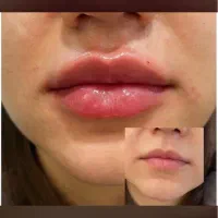 آموزش تخصصی ژل و بوتاکس|خدمات آموزشی|تهران, تهرانپارس شرقی|دیوار