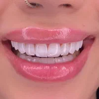 دندان کامپوزیت دندانپزشکی باهوش مصنوعی|خدمات آرایشگری و زیبایی|مشهد, دانشجو|دیوار