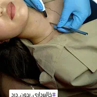 لیزر موهای زائد، ریمو تتو، خالبرداری زگیل میخچه|خدمات آرایشگری و زیبایی|ارومیه, |دیوار