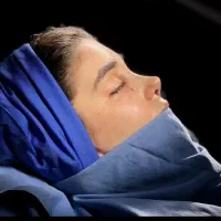 آف ویژه عمل جراحی زیبایی بینی/ لیفت/ لیپوساکشن