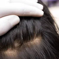 پاکسازی موتضمینی