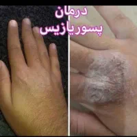 سلامتی تمام بدن با پاک سازی و اصلاح مزاج