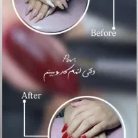 تخفیف کاشت ناخن به مناسبت روز مادر و شب یلدا