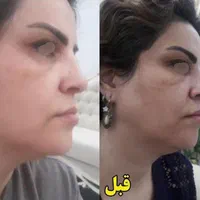 تنها دفترپخش درتهران کرم ضدلک لاکچری کوین((اصلی))|آرایشی، بهداشتی، درمانی|تهران, تجریش|دیوار