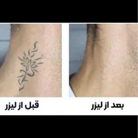 ریمو انواع تتو و خالکوبی ها