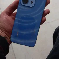 گوشی شیائومی ردمی ۱۵