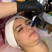 فیشال و پاکسازی پوست|خدمات آرایشگری و زیبایی|بابلسر, |دیوار