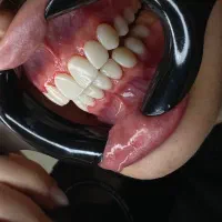 جشنواره ۶۰درصدی کامپوزیت