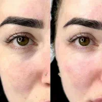 مرکز زیبایی با بروزترین دستگاه های روز دنیا|خدمات آرایشگری و زیبایی|ماهدشت, |دیوار