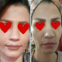 کرم پف صورت فرانسوی اصلی تضمینی|آرایشی، بهداشتی، درمانی|ایلام, |دیوار