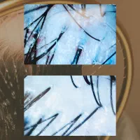 تخفیف ویژه اسکراب اسکالپ سر و‌کراتین