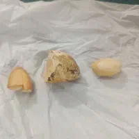 انگشتر