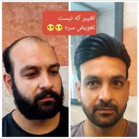 خدمات پروتز و ترمیم مو/پروتز دائم/پروتز مو|خدمات آرایشگری و زیبایی|اصفهان, وحید|دیوار